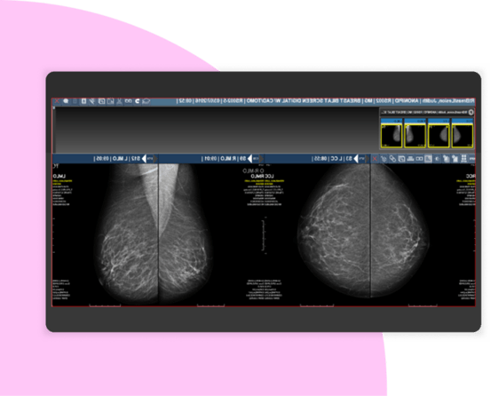 IMG-Merge-PACS-001-1125x911 1