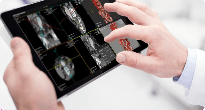 IMG-Merge-Blog-Body-90-744x400