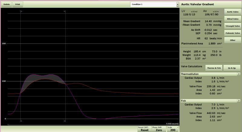 IMG-Merge-Web-Blog-Hemo-Waveforms-001