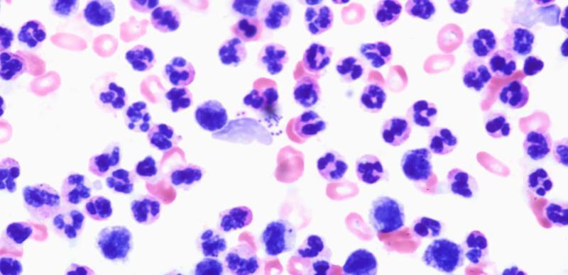 stock-photo-infection