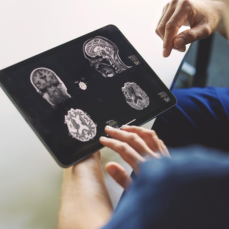 Doctor interacting with tablet view of radiology scans